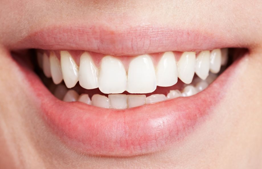 Aligner Behandlung mit schönen Zähnen